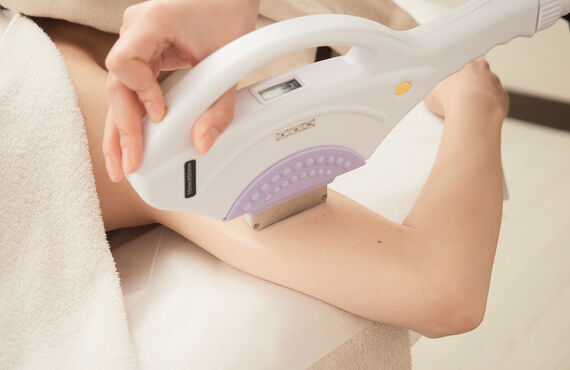 みよし市脱毛　結果の早いフォトRF脱毛